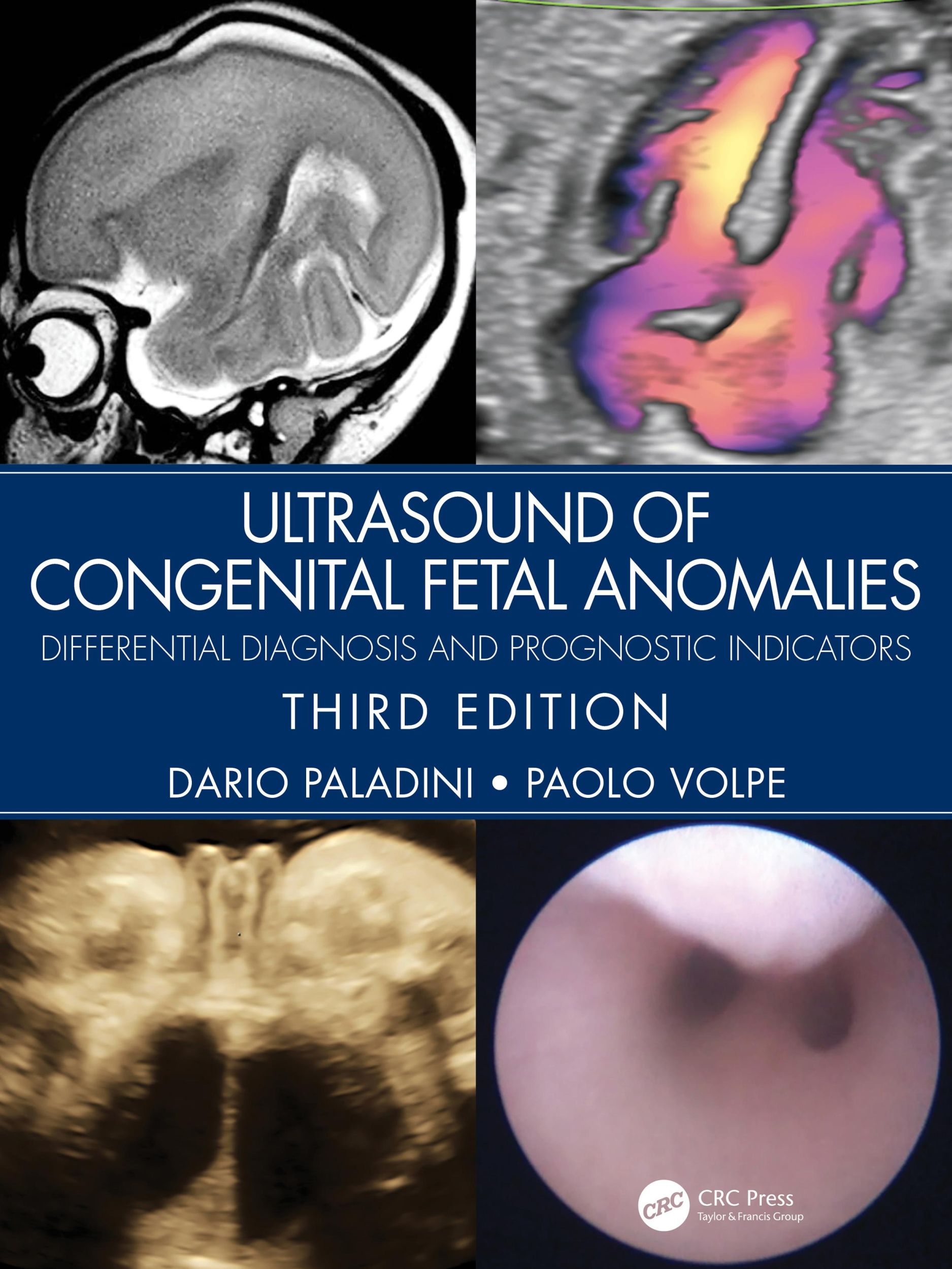 Cover: 9780367499501 | Ultrasound of Congenital Fetal Anomalies | Dario Paladini (u. a.)