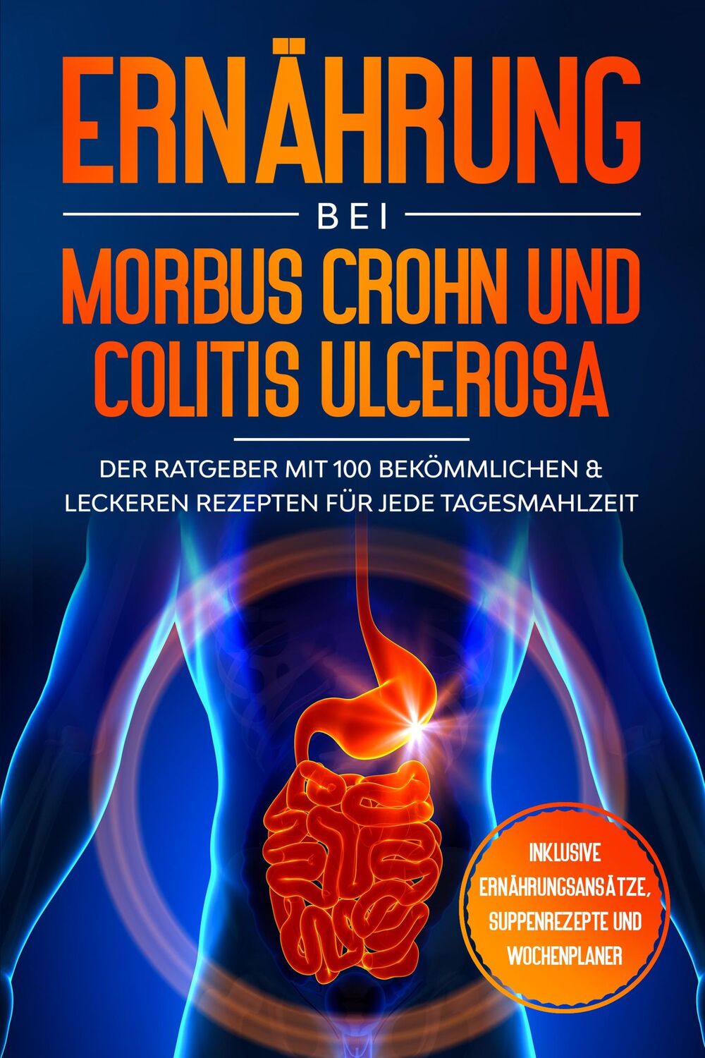 Cover: 9783989101326 | Ernährung bei Morbus Crohn und Colitis Ulcerosa: Der Ratgeber mit...