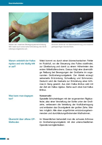 Bild: 9783966641999 | Medizin in Fakten: Gesunder Fuß | Michael Vitek | Taschenbuch | 128 S.