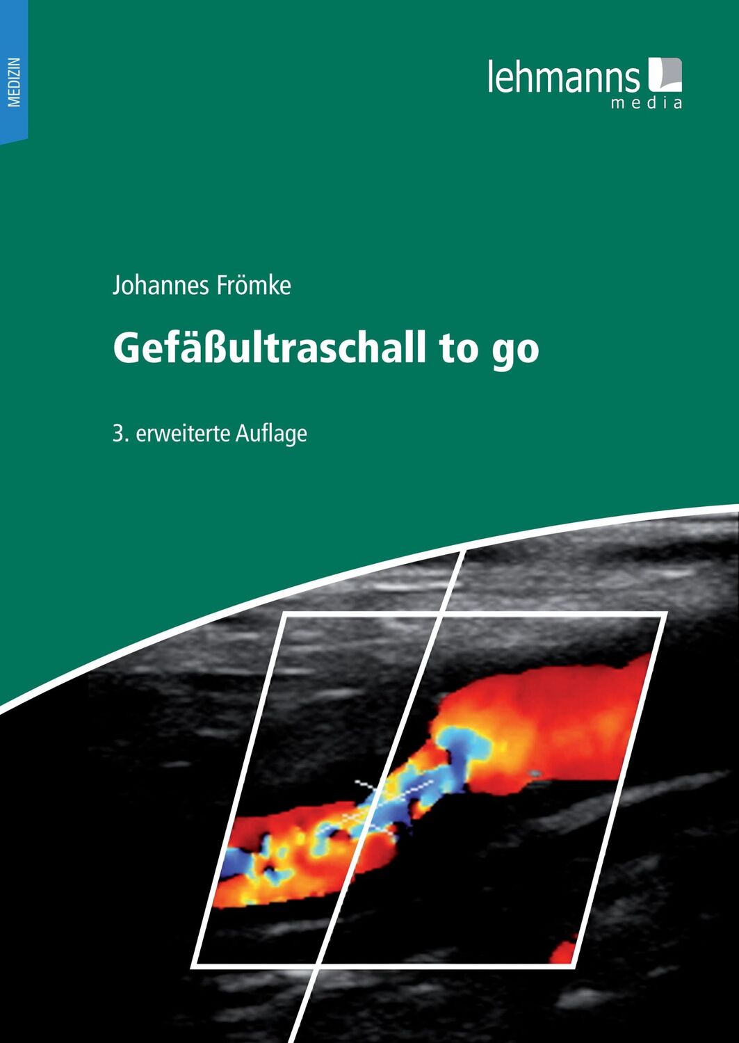 Cover: 9783965435032 | Gefäßultraschall to go | Johannes Frömke | Taschenbuch | 357 S. | 2024