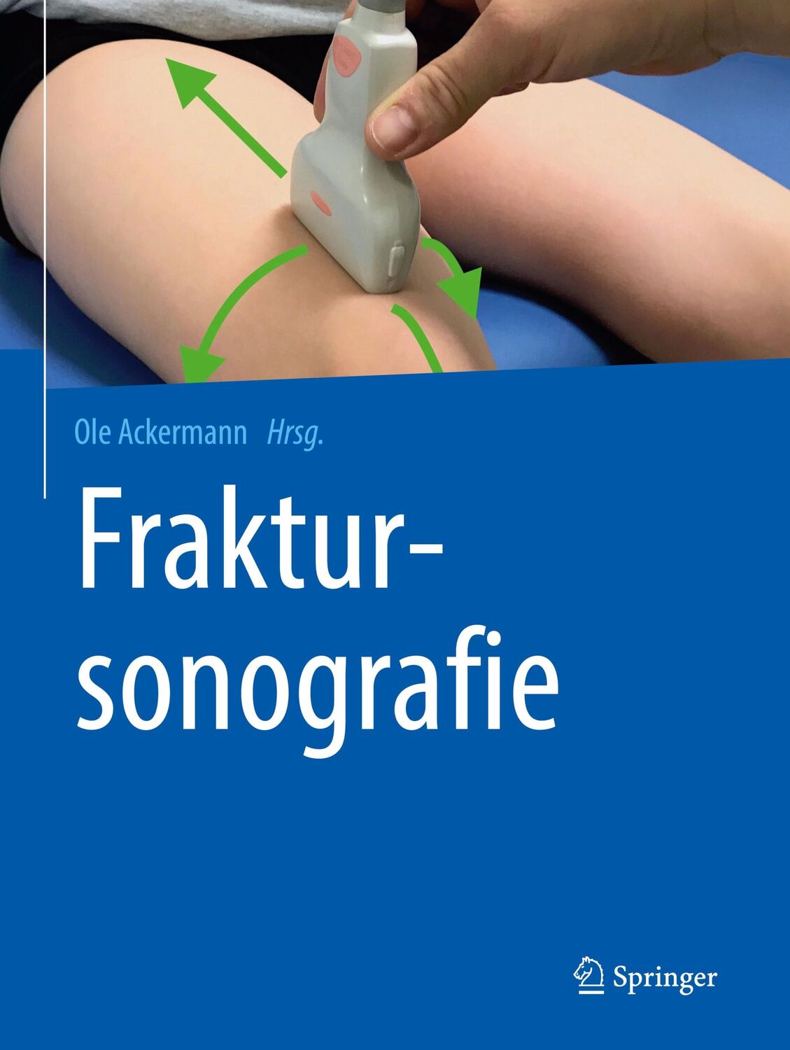 Cover: 9783662585078 | Fraktursonografie | Ole Ackermann | Buch | HC runder Rücken kaschiert