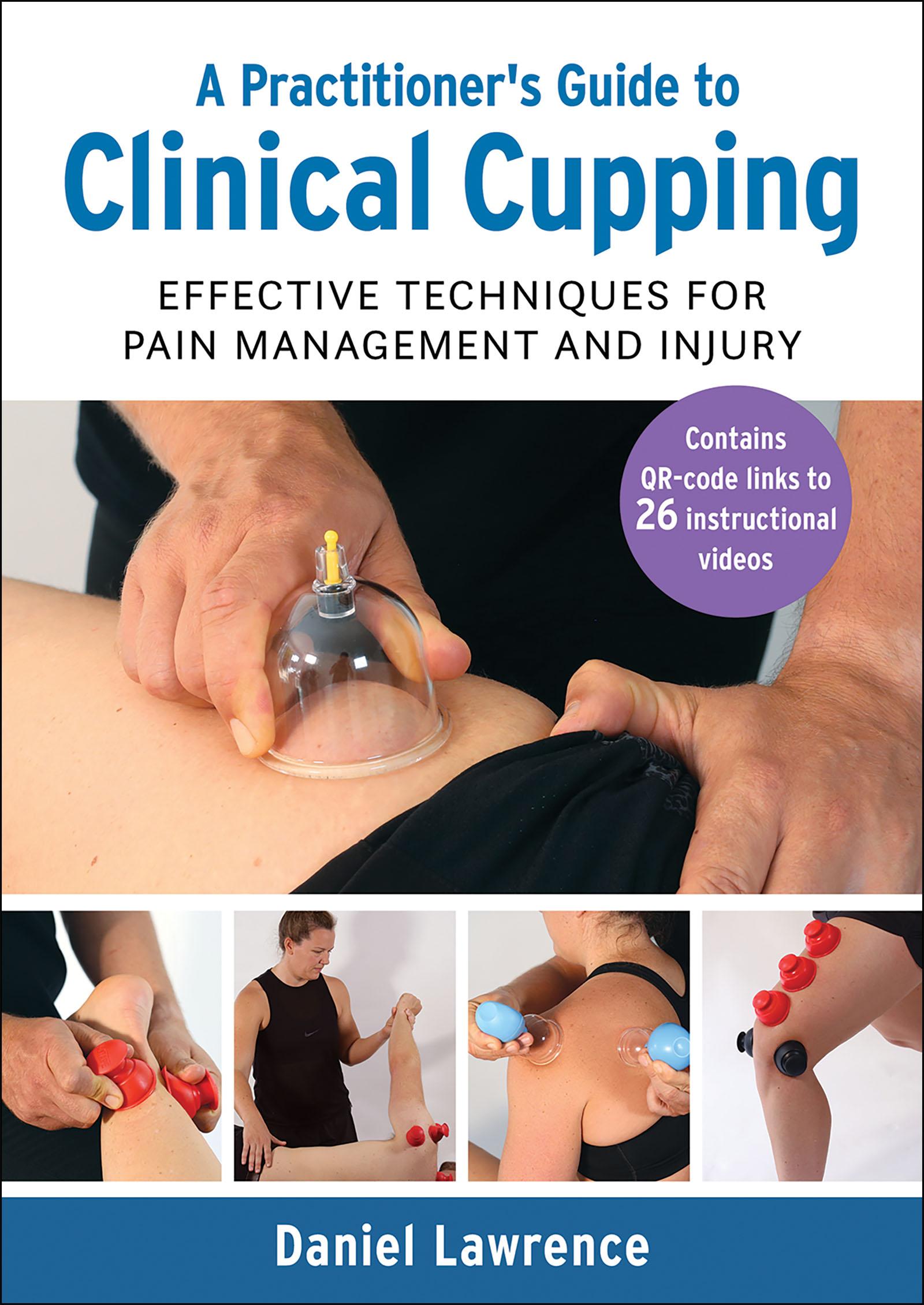 Cover: 9781913088330 | A Practitioner's Guide to Clinical Cupping | Daniel Lawrence | Buch