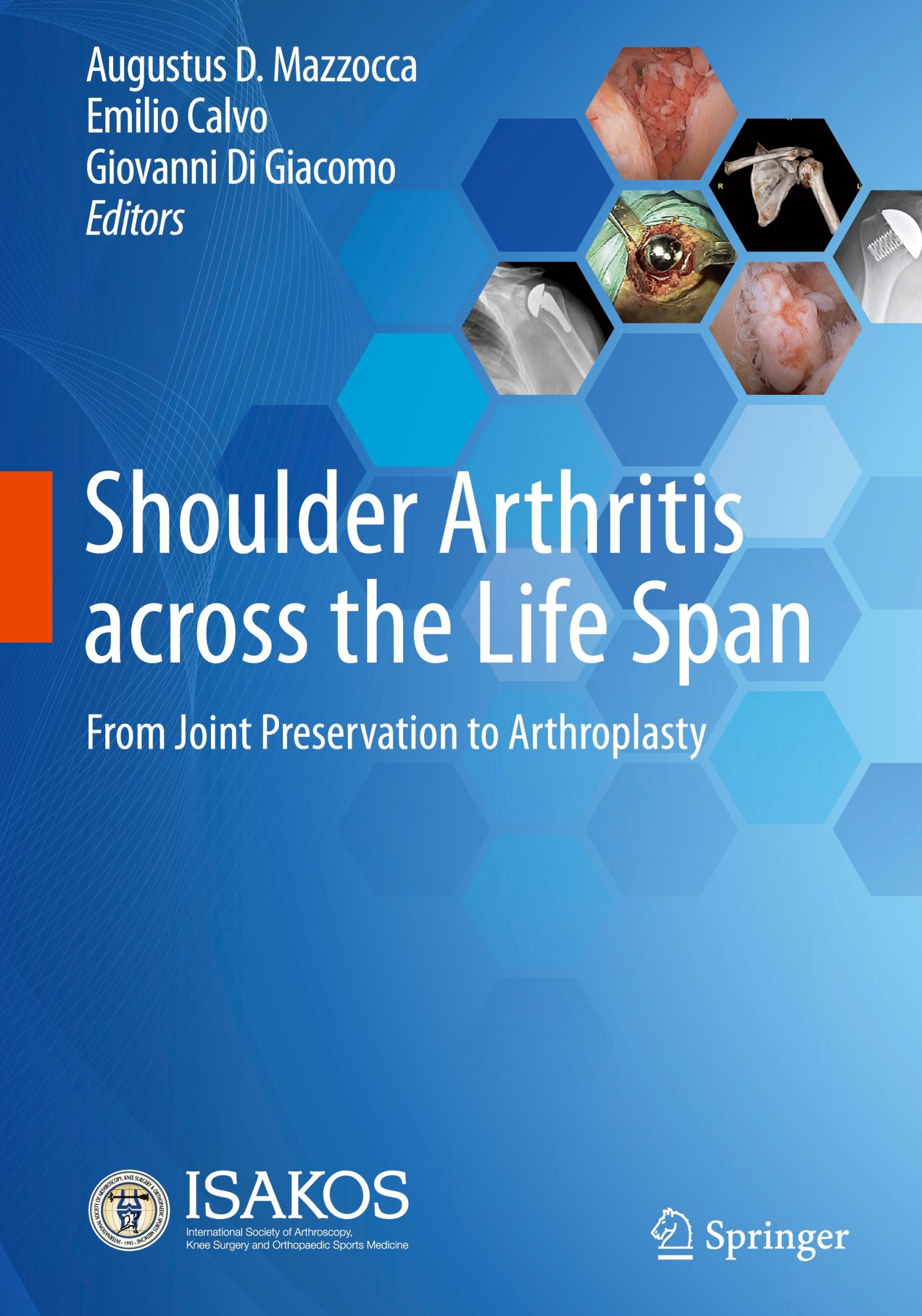 Cover: 9783031332975 | Shoulder Arthritis across the Life Span | Augustus D. Mazzocca (u. a.)