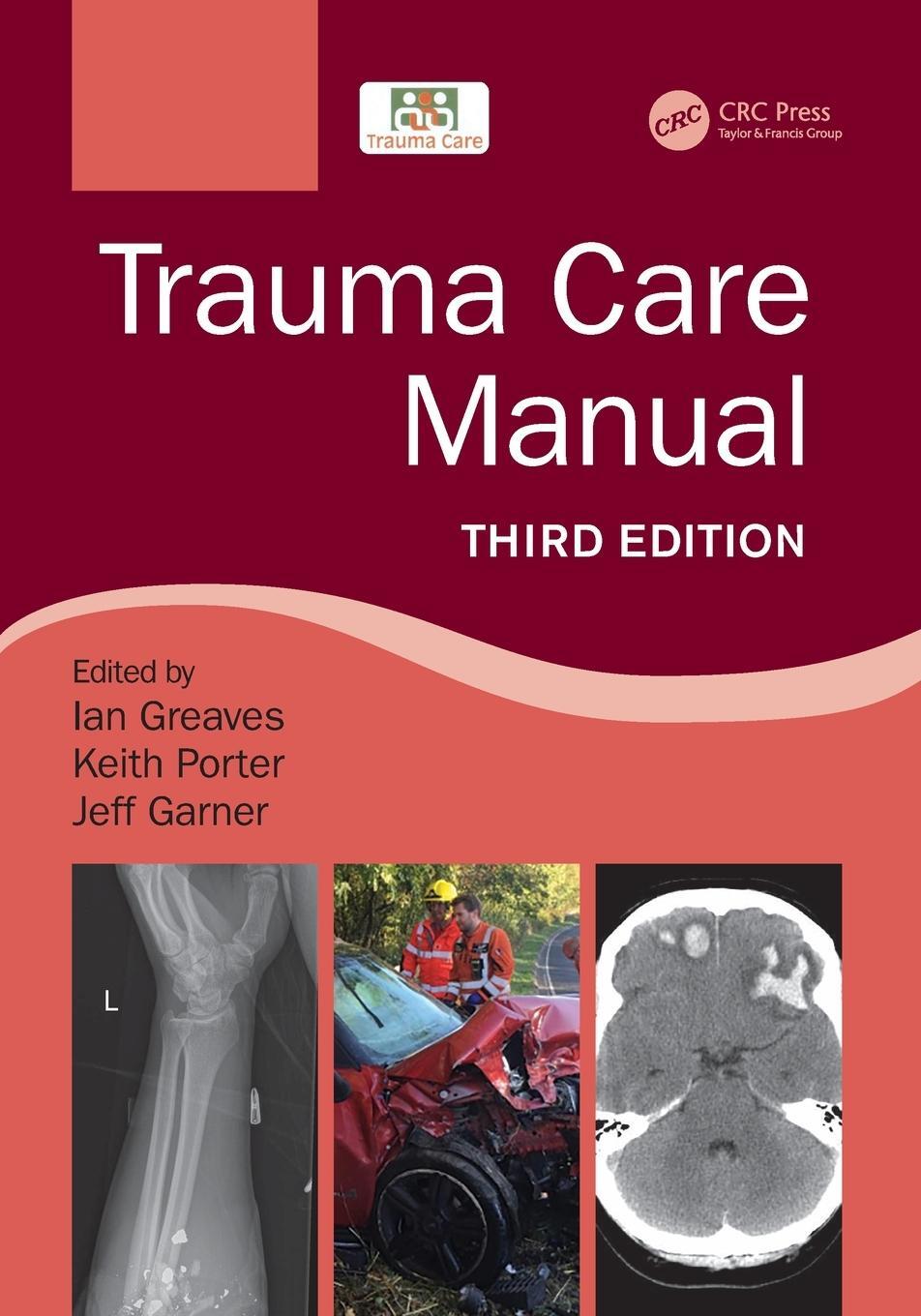 Cover: 9781498788847 | Trauma Care Manual | Ian Greaves (u. a.) | Taschenbuch | Englisch