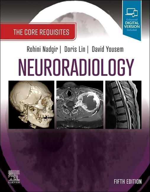 Cover: 9780323759755 | Neuroradiology | The Core Requisites | David M. Yousem (u. a.) | Buch