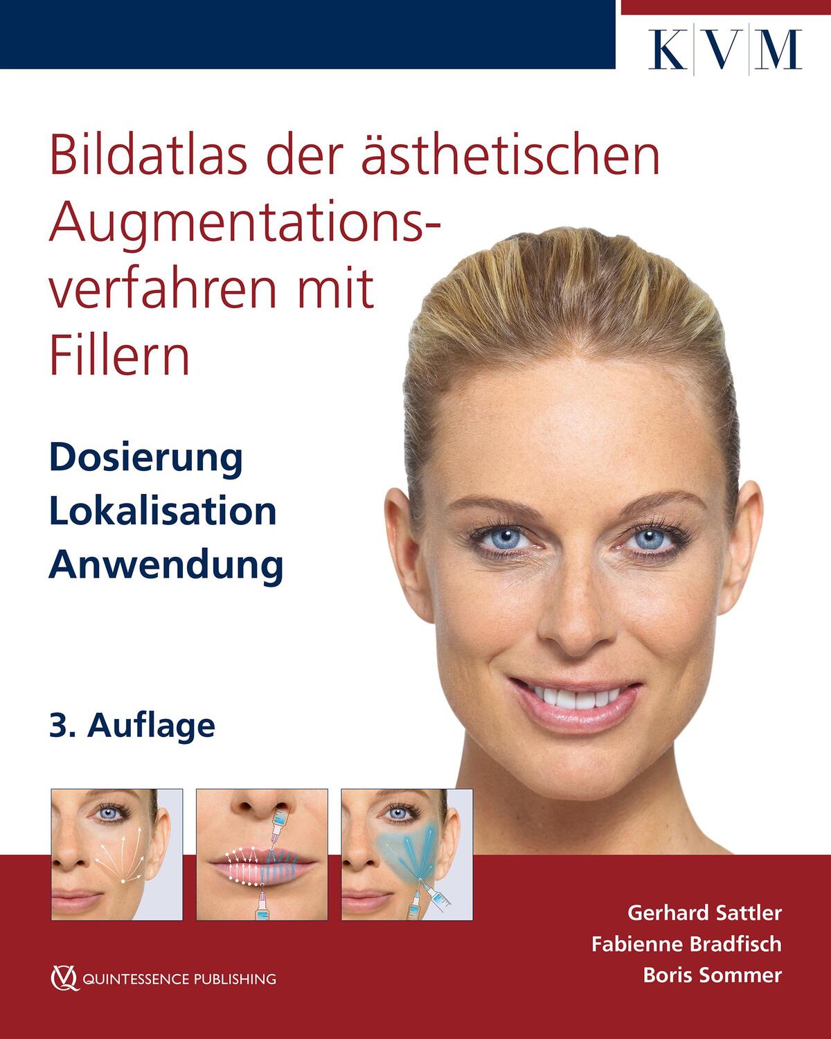 Cover: 9783868676952 | Bildatlas der ästhetischen Augmentationsverfahren mit Fillern | Buch