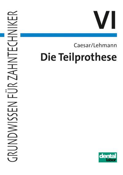 Cover: 9783937346427 | Die Teilprothese | Hans H. Caesar (u. a.) | Taschenbuch | 206 S.