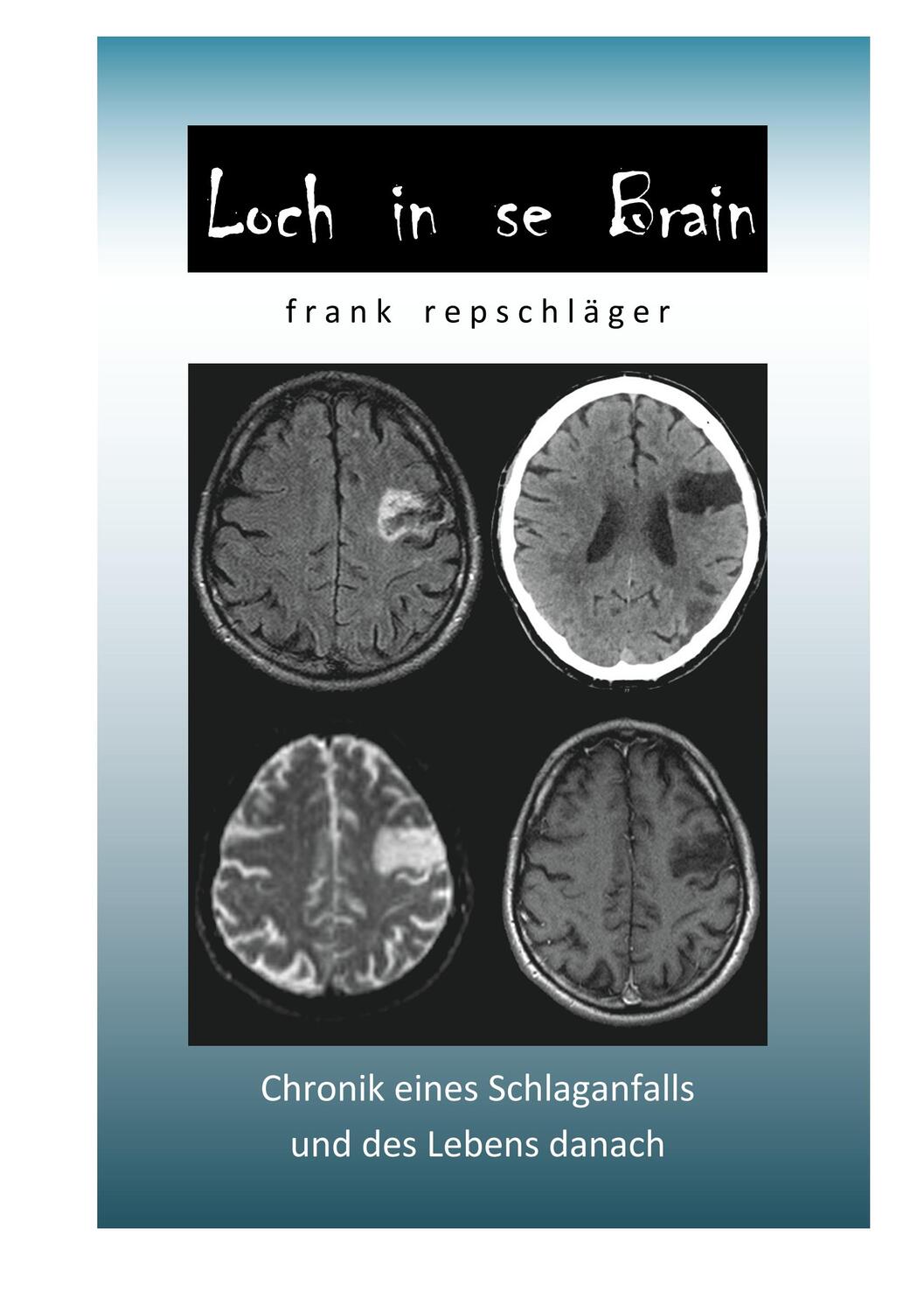 Cover: 9783749410347 | Loch in se Brain | Chronik eines Schlaganfalls und des Lebens danach