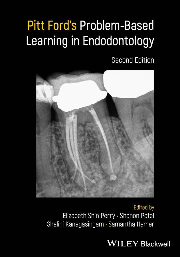 Cover: 9781119565970 | Pitt Ford's Problem-Based Learning in Endodontology | Perry (u. a.)