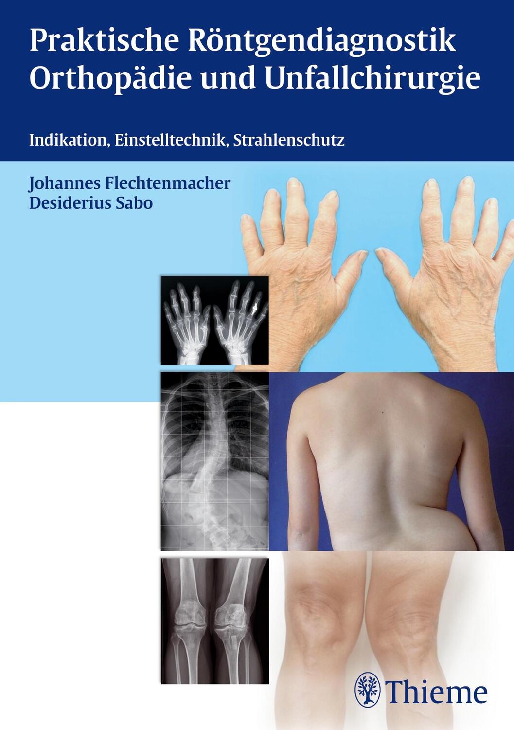 Cover: 9783131731616 | Praktische Röntgendiagnostik Orthopädie und Unfallchirurgie | Buch