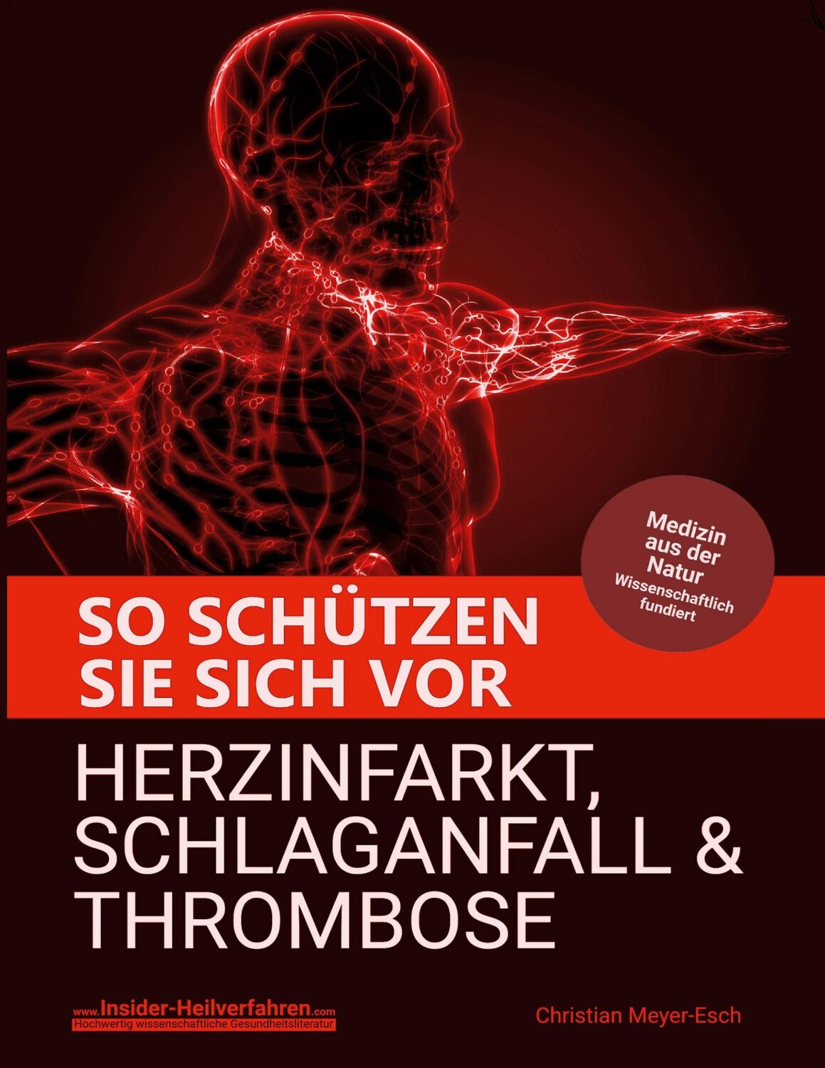 Cover: 9783759759689 | So schützen Sie sich vor Herzinfarkt, Schlaganfall und Thrombose