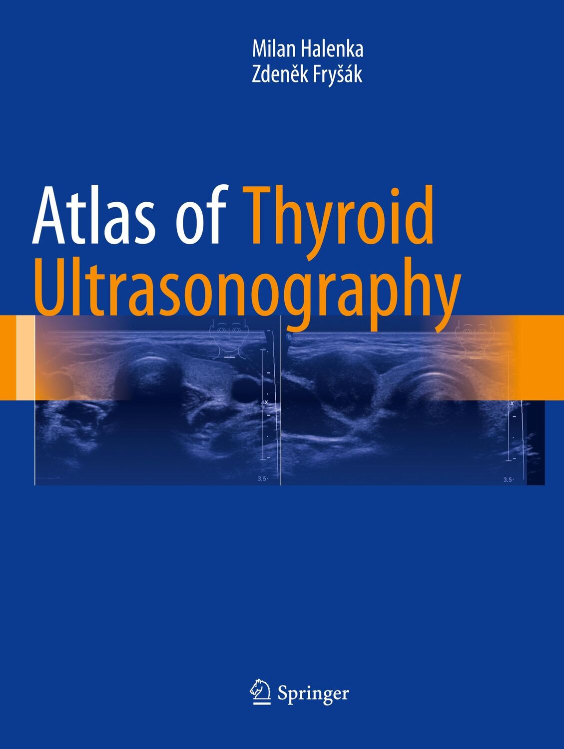 Cover: 9783319852379 | Atlas of Thyroid Ultrasonography | Zden¿k Fry¿ák (u. a.) | Taschenbuch