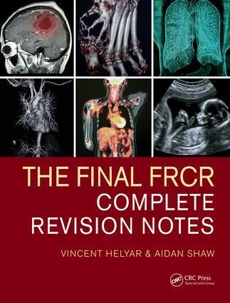 Cover: 9781482259728 | The Final FRCR | Complete Revision Notes | Aidan Shaw (u. a.) | Buch