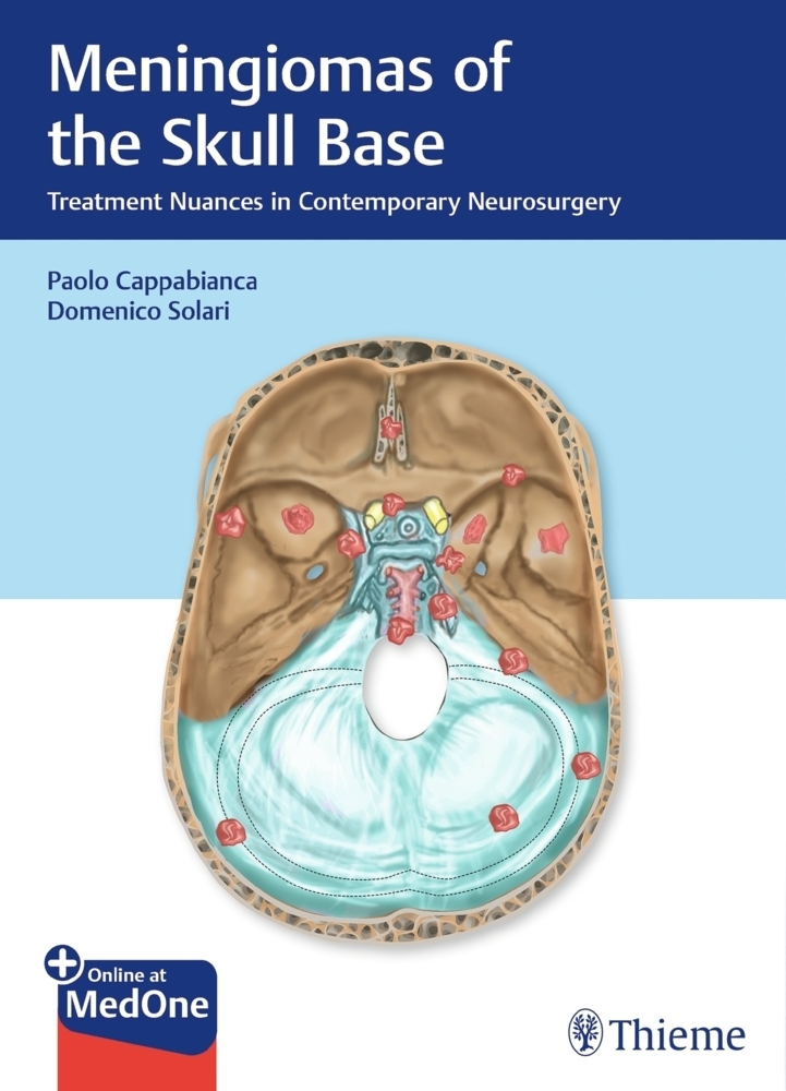 Cover: 9783132412866 | Meningiomas of the Skull Base | Paolo Cappabianca (u. a.) | Bundle