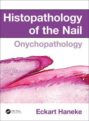 Cover: 9781482212327 | Histopathology of the Nail | Onychopathology | Eckart Haneke | Buch