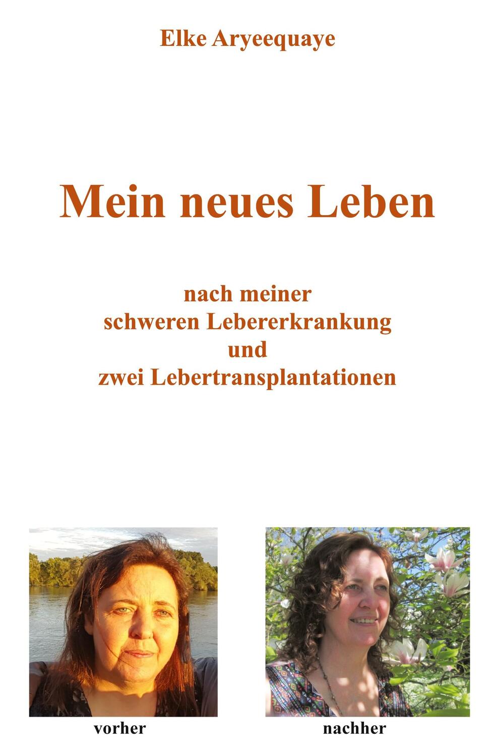 Cover: 9783961034345 | Mein neues Leben | Elke Aryeequaye | Taschenbuch | Paperback | 82 S.