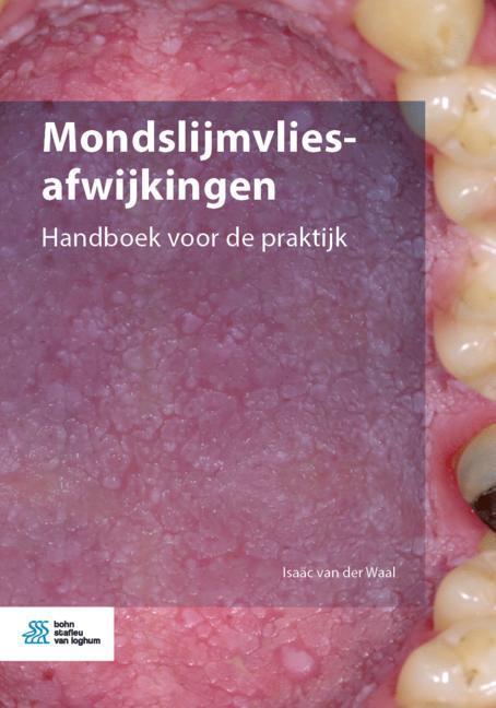 Cover: 9789036824019 | Mondslijmvliesafwijkingen | Handboek Voor de Praktijk | Waal | Buch