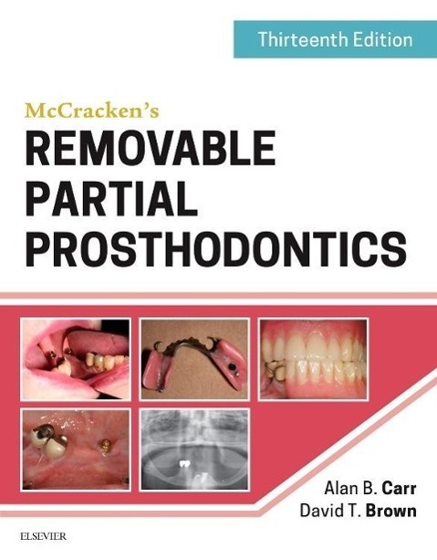 Cover: 9780323339902 | McCracken's Removable Partial Prosthodontics | Alan B. Carr (u. a.)