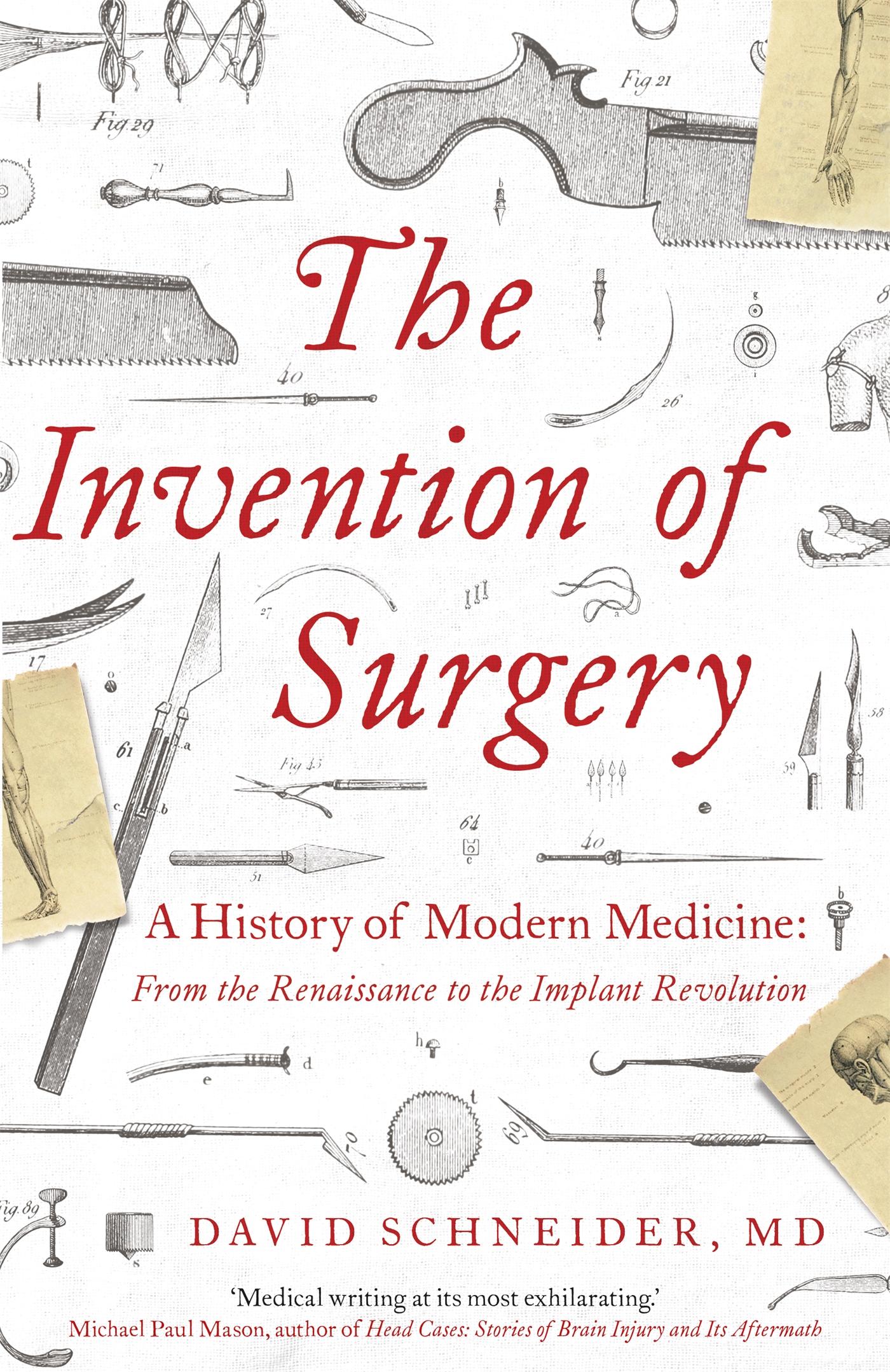 Cover: 9781529362268 | The Invention of Surgery | David Schneider | Taschenbuch | Englisch