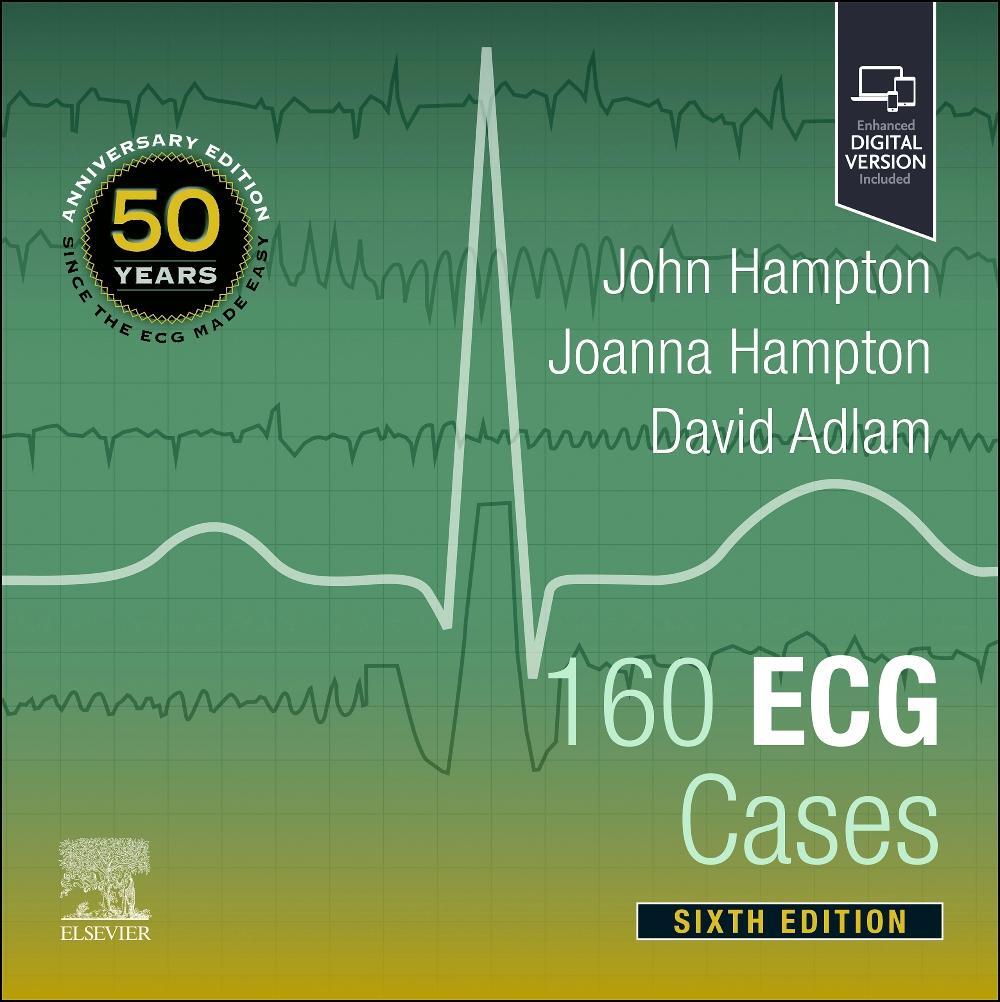 Cover: 9780323937658 | 160 ECG Cases | David Adlam (u. a.) | Taschenbuch | Englisch | 2024