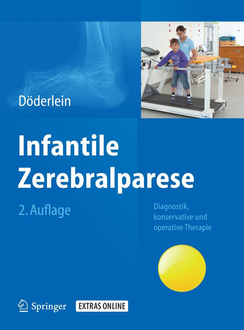 Cover: 9783642353185 | Infantile Zerebralparese | Leonhard Döderlein | Buch | xiv | Deutsch