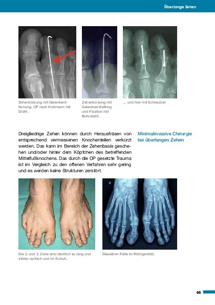 Bild: 9783966641999 | Medizin in Fakten: Gesunder Fuß | Michael Vitek | Taschenbuch | 128 S.