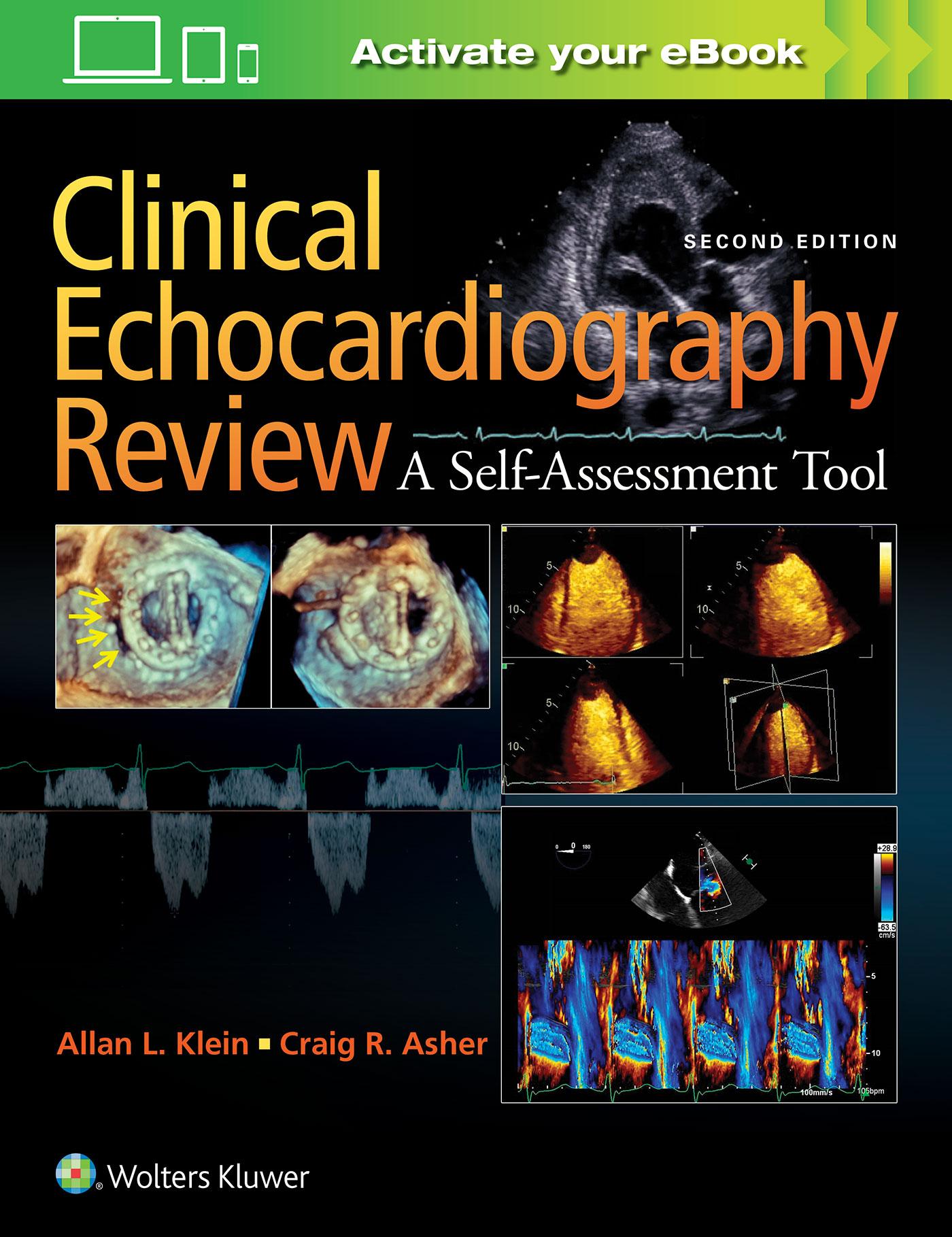 Cover: 9781451195378 | Clinical Echocardiography Review | Allan L. Klein | Taschenbuch | 2017