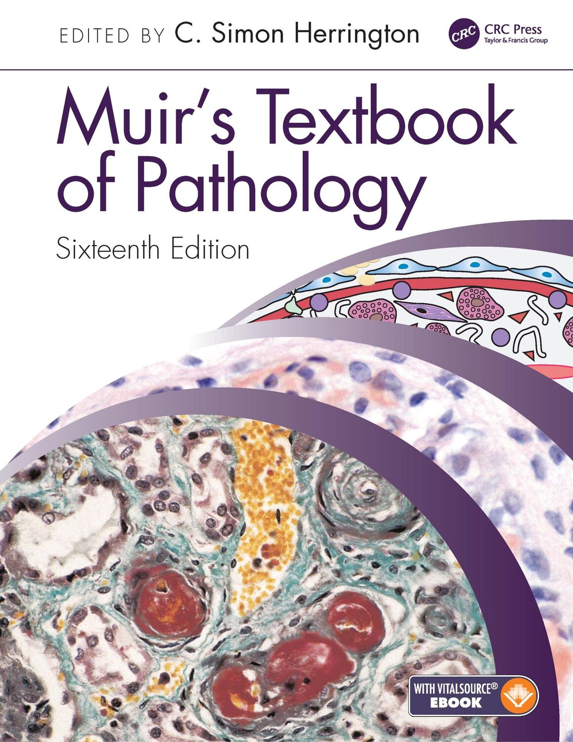 Cover: 9780367146719 | Muir's Textbook of Pathology | C Simon Herrington | Taschenbuch | 2020