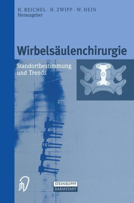 Cover: 9783642633300 | Wirbelsäulenchirurgie | Standortbestimmung und Trends | Taschenbuch